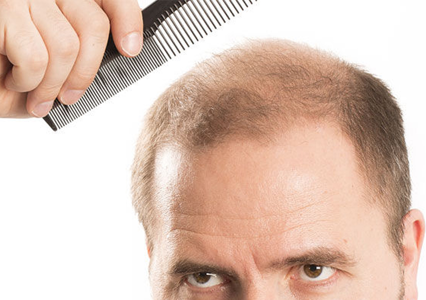 Hair Transplant for Wounded Area - HairMag Turkey